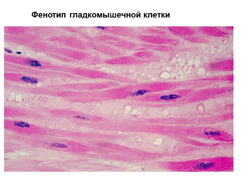 Фенотип гладкомышечной клетки